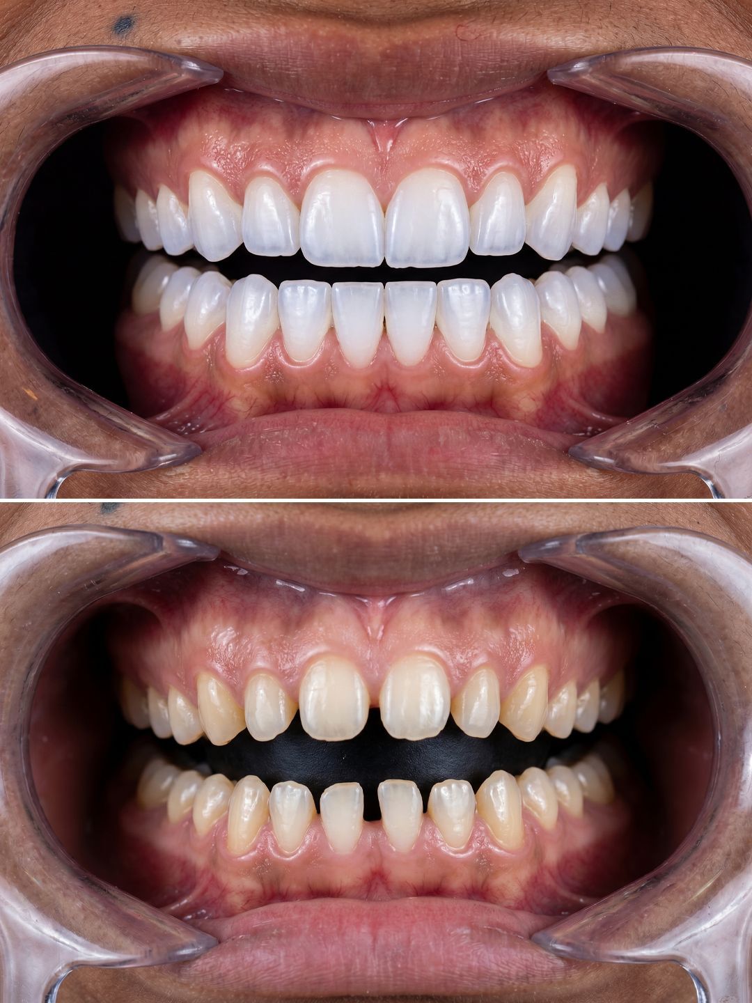Teeth case 3 — carousel slide 1