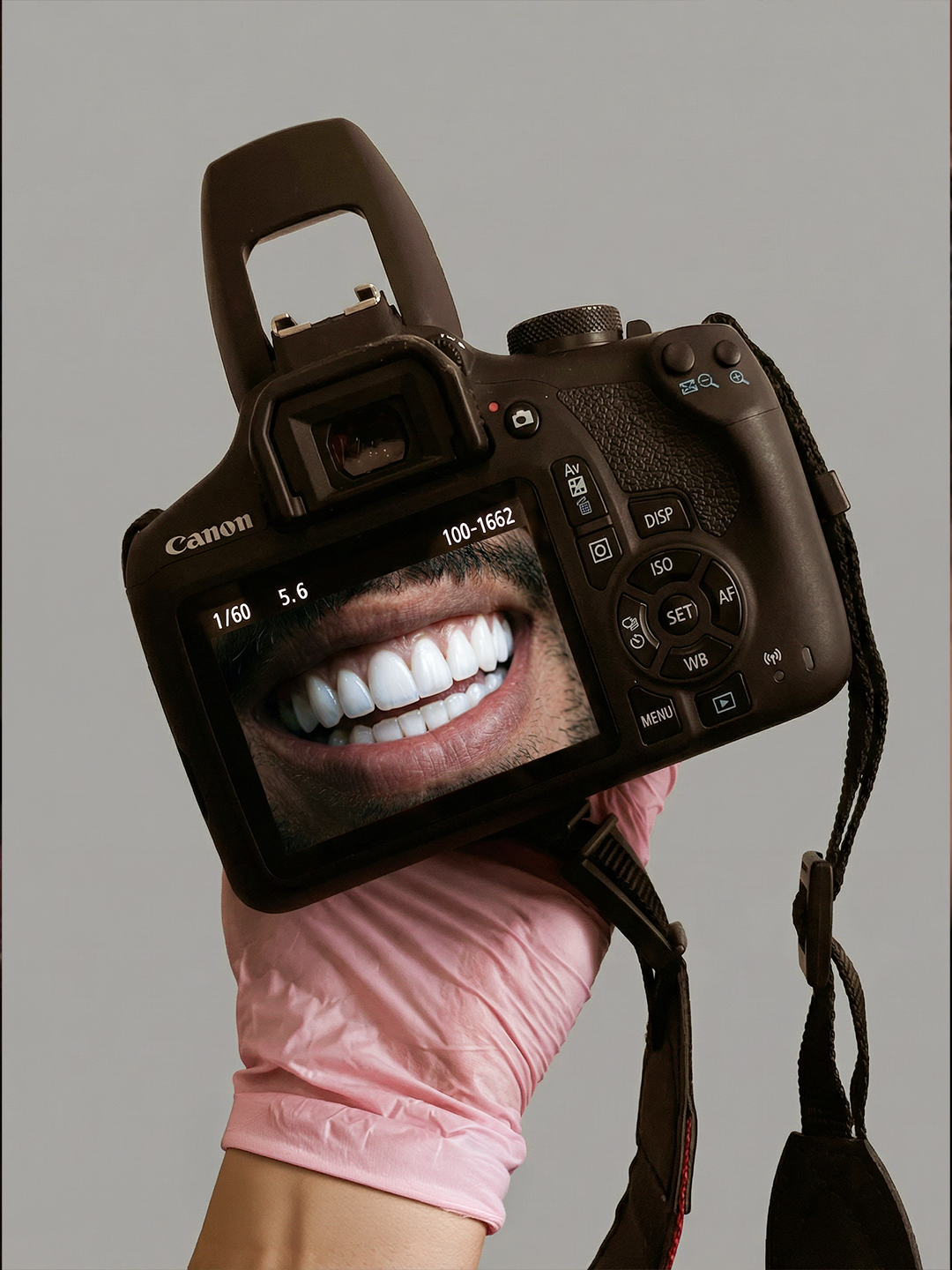 Teeth case 2 — carousel slide 1