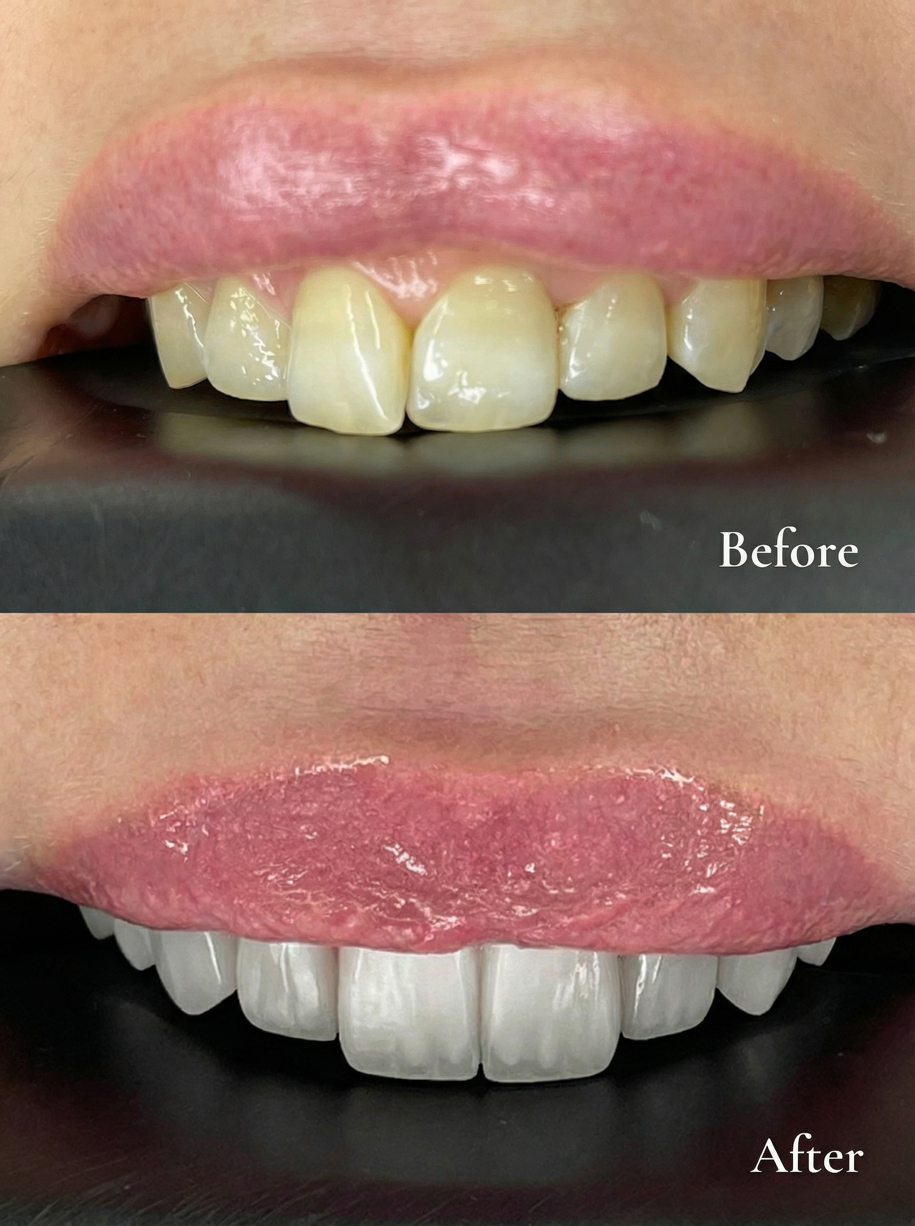 Teeth case 1 — carousel slide 1
